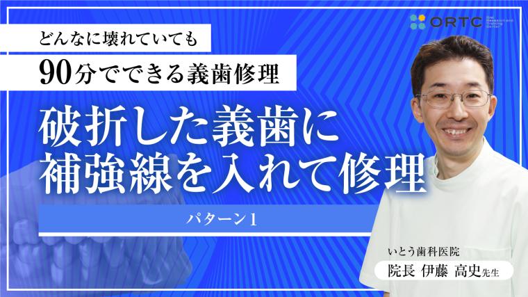 破折した義歯に 補強線を入れて修理 パターン１ 伊藤高史