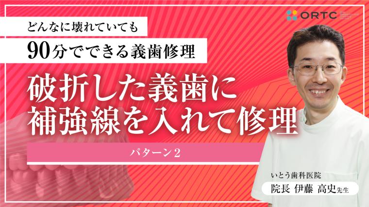 破折した義歯に 補強線を入れて修理 パターン２ 伊藤高史