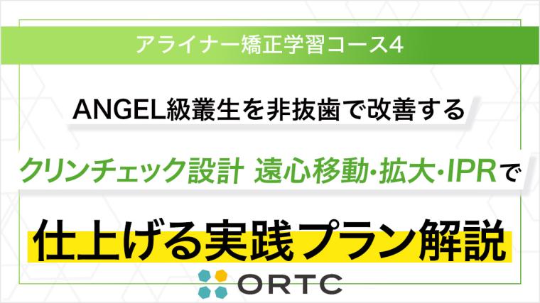 AngleⅠ級叢生を非抜歯で改善するクリンチェック設計 遠心移動・拡大・IPRで仕上げる実践プラン解説 ORTC