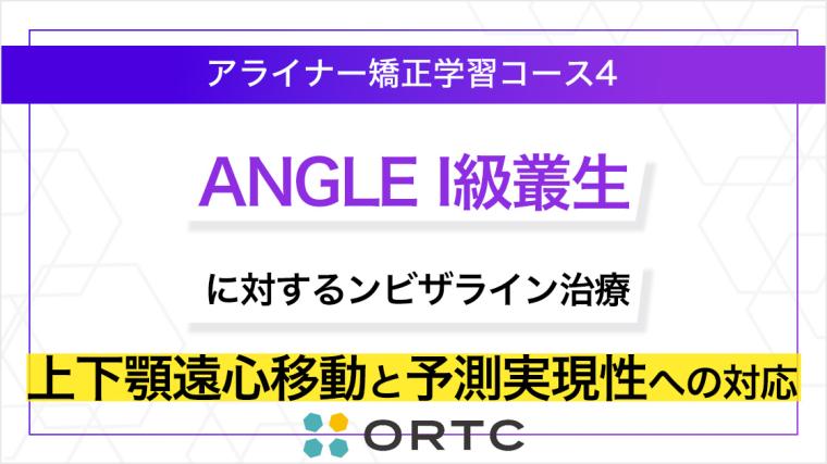 ANGLE I級叢生に対するインビザライン治療：上下顎遠心移動と予測実現性への対応 ORTC