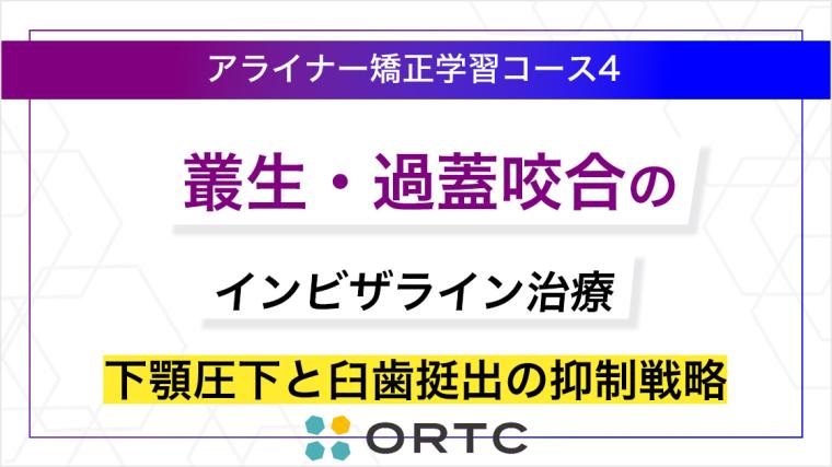 叢生・過蓋咬合のインビザライン治療：下顎圧下と臼歯挺出の抑制戦略 ORTC