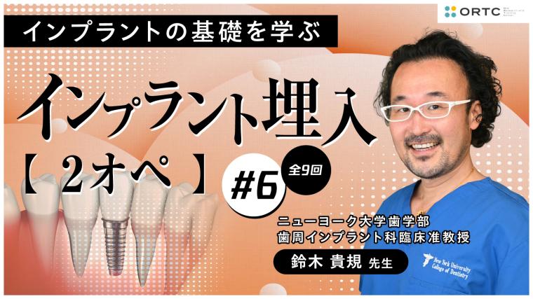 インプラント埋入2オペ　PART6 鈴木貴規