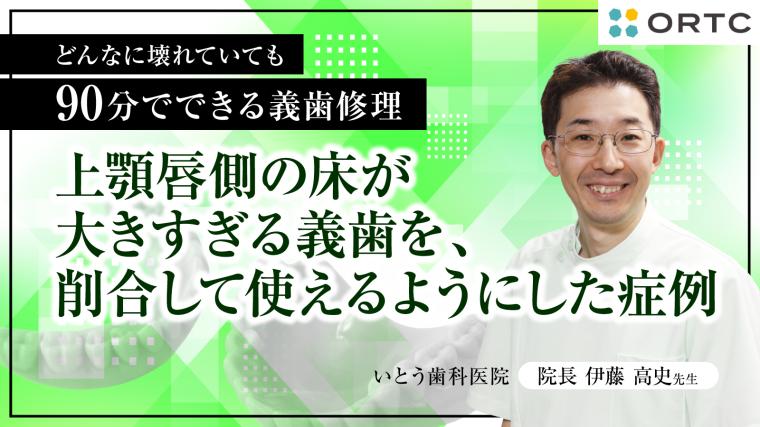 上顎唇側の床が大きすぎる義歯を、削合して使えるようにした症例 伊藤高史