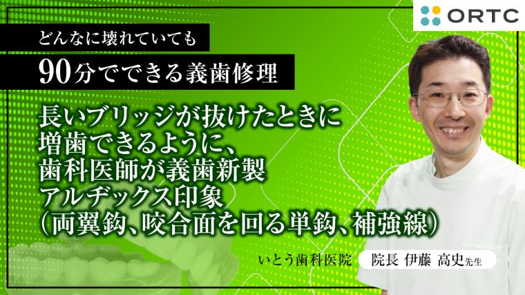 長いブリッジが抜けたときに増歯できるように、歯科医師が義歯新製　アルヂックス印象（両翼鈎、咬合面を回る単鈎、補強線） 伊藤高史