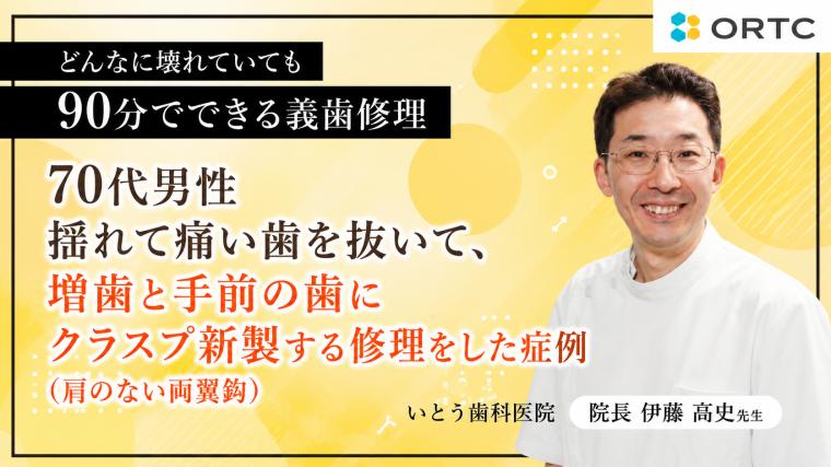 70代男性揺れて痛い歯を抜いて、増歯と手前の歯にクラスプ新製する修理をした症例（肩のない両翼鈎） 伊藤高史