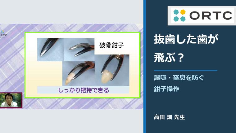 抜歯した歯が飛ぶ？誤嚥・窒息を防ぐ鉗子操作 高田訓