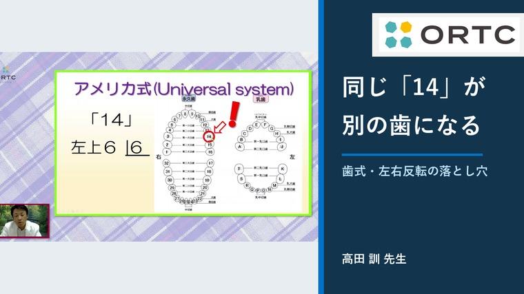 誤抜歯はなぜ起きる？歯式表記・左右反転・術前照合の落とし穴 高田訓