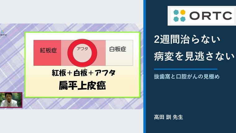 その歯、本当に抜いてよい？口腔がんの見逃しと2週間ルール 高田訓