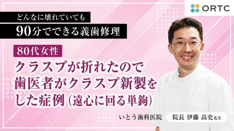 80代女性、クラスプが折れたので歯医者がクラスプ新製をした症例（遠心に回る単鉤） 伊藤高史