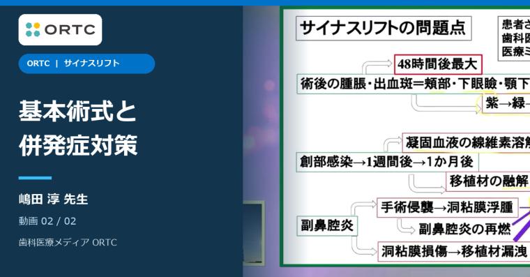 サイナスリフト｜基本術式と併発症対策 嶋田淳