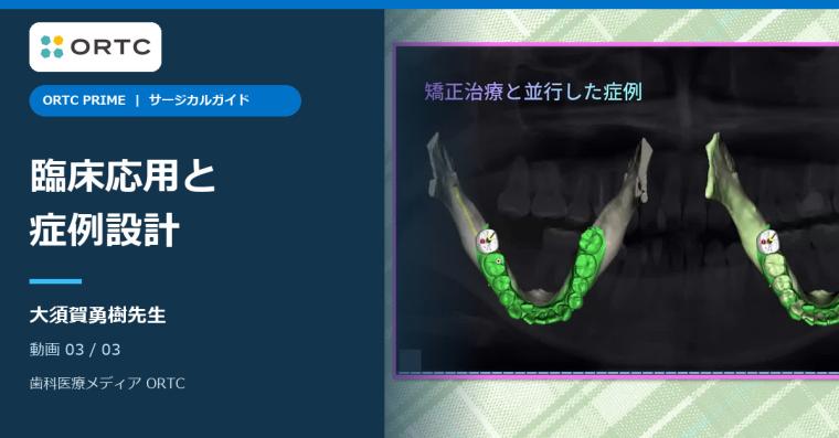 サージカルガイド｜臨床応用と症例設計 大須賀勇樹