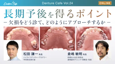 長期予後を得るポイント～欠損をどう診て、どのようにアプローチするか～｜Denture Cafe vol.24