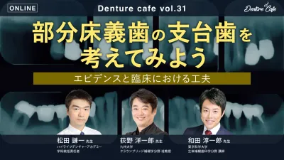 部分床義歯の支台歯を考えてみよう -エビデンスと臨床における工夫｜Denture Cafe vol.31