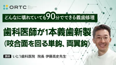歯科医師が1本義歯新製 （咬合面を回る単鈎、両翼鈎）