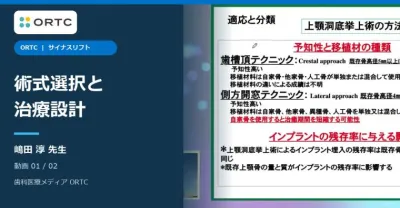 サイナスリフト|術式選択と治療設計の基本
