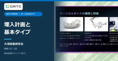 サージカルガイド|補綴主導の埋入計画と基本タイプ