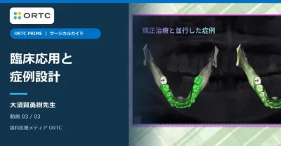 サージカルガイド|臨床応用と症例設計