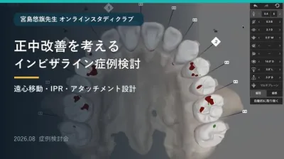正中改善を考えるインビザライン症例検討｜遠心移…