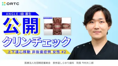 ANGLE I級 叢生 上下遠心移動 非抜歯症例 女性