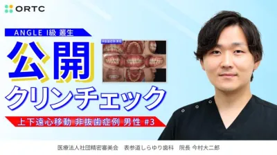 ANGLE I級 叢生 上下遠心移動 非抜歯症例 男性