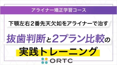 下顎左右2番先天欠如をアライナーで治す：抜歯判断と2プラン比較の実践トレーニング
