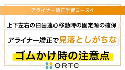 上下左右の臼歯遠心移動時の固定源の確保：アライナー矯正で見落としがちなゴムかけ時の注意点