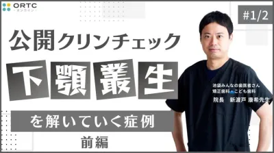 下顎叢生を解いていく症例_公開クリンチェック1
