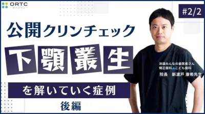 下顎叢生を解いていく症例_公開クリンチェック2