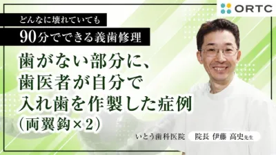 歯がない部分に、歯医者が自分で入れ歯を作製した症例（両翼鈎×２）
