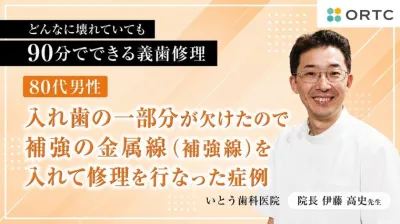 80代男性、入れ歯の一部分が欠けたので補強の金属線（補強線）を入れて修理を行なった症例 伊藤高史