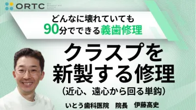 クラスプを新製する修理（近心、遠心から回る単鈎）